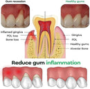 50ML Damaged Gum RepairCare Gel Serum Relieve Sore Gums Allergy Deep Cleaning Teeth Stains Tartar Serum Dental Caries Toothpaste